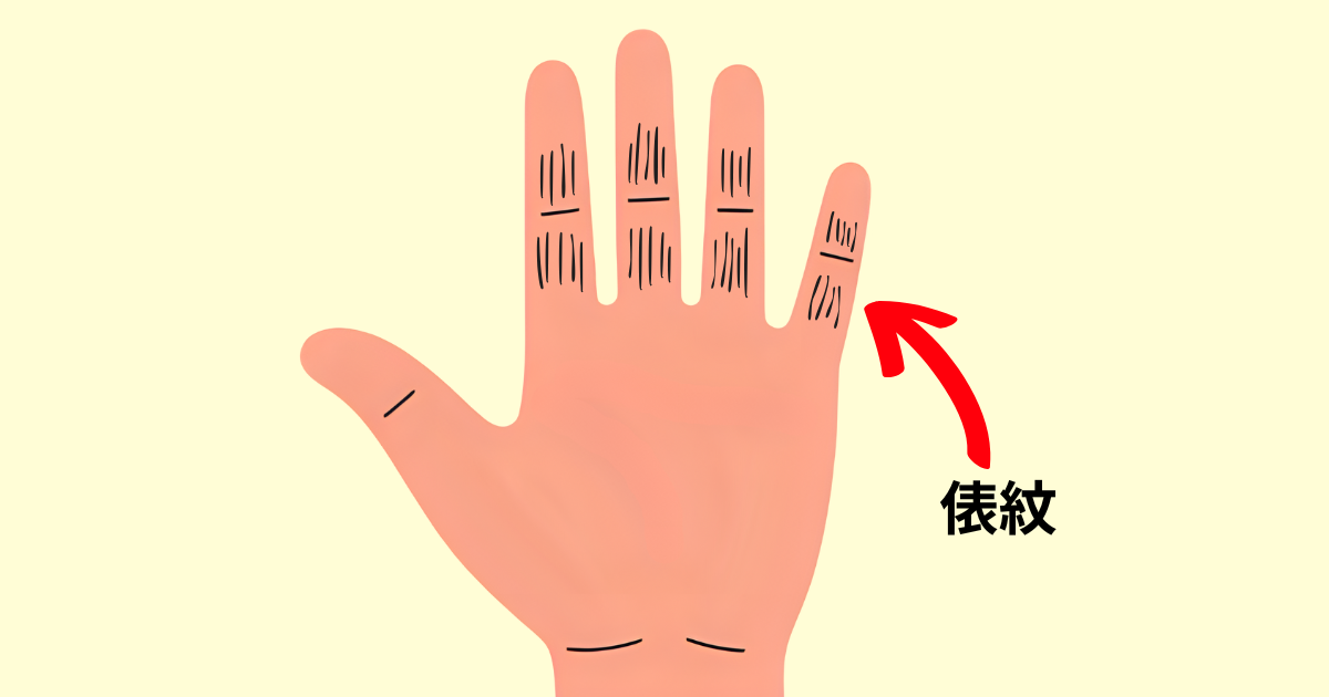 俵紋はお金持ちになる手相